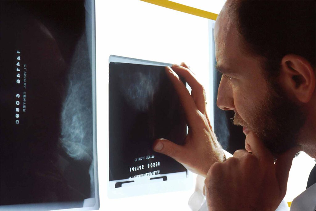 Arzt wertet Mammographie aus