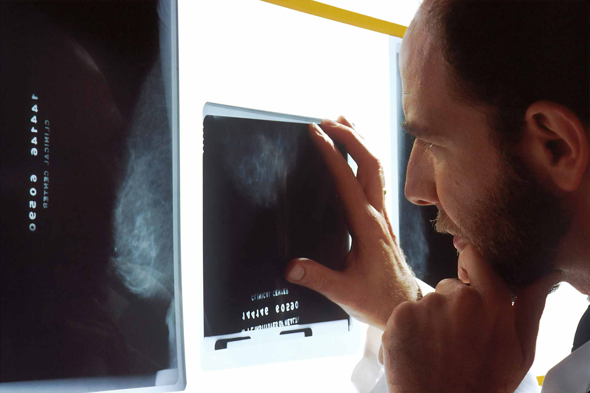 Arzt wertet Mammographie aus