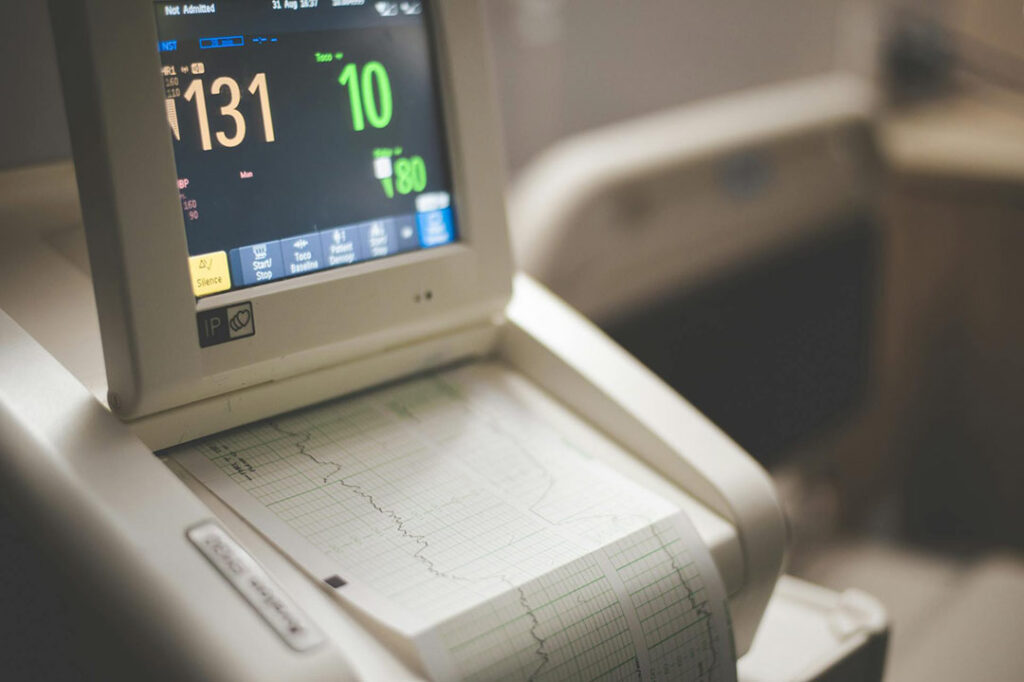 EKG-Gerät zeichnet Herztätigkeit auf